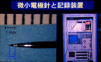 微小電極記録